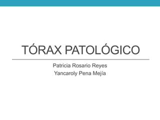 TÓRAX PATOLÓGICO
Patricia Rosario Reyes
Yancaroly Pena Mejía

 