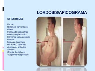 LORDOSIS/APICOGRAMA
DIRECTRICES
De pie
Distancia 90/1 mts del
chasis
Inclinando hacia atrás
cuello y espalda alta
Hombros hacia adelante
rotados
Manos a la cintura,
PMS y RC centrado
debajo del apéndice
xifoides
Chasis: 24x30 cms
Suspender respiración
 