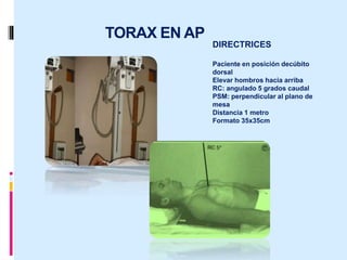 TORAX EN AP
DIRECTRICES
Paciente en posición decúbito
dorsal
Elevar hombros hacia arriba
RC: angulado 5 grados caudal
PSM: perpendicular al plano de
mesa
Distancia 1 metro
Formato 35x35cm
 
