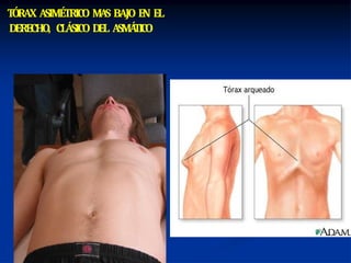 Rod Gyug TORAX SEMIO .pptx gyug | PPTX