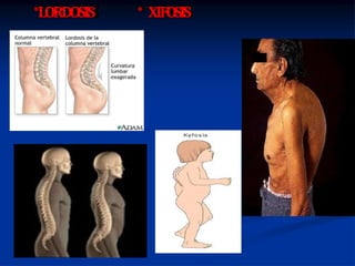 Rod Gyug TORAX SEMIO .pptx gyug | PPTX