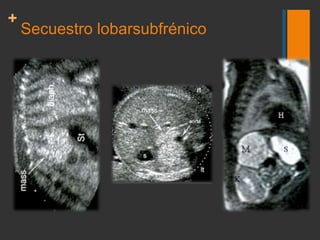 Radiology: Volume 247: Number 3—June 2008<br />