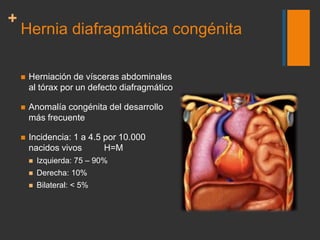 Síndrome de la Cimitarra<br />RadioGraphics 2004, 24, e17.<br />