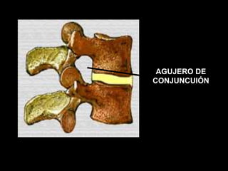 AGUJERO DE
CONJUNCUIÓN
 