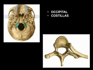 • OCCIPITAL
• COSTILLAS
 