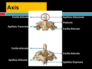 Axis
Apófisis OdontoideCarilla Articular
Carilla Articular
Carilla Articular
Apófisis Espinosa
Apófisis Articular
Pedículo
Apófisis Transversa
Carilla Articular
 