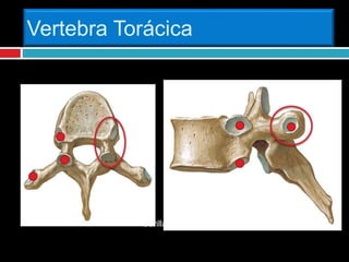 Vertebra Torácica
Carilla Articular
 