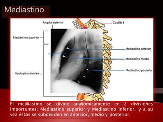 Mediastino 
El mediastino se divide anatómicamente en 2 divisiones 
importantes: Mediastino superior y Mediastino inferior...