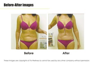 Before-After images
AfterBefore
These images are copyrights of 7e Wellness & cannot be used by any other company without permission
 