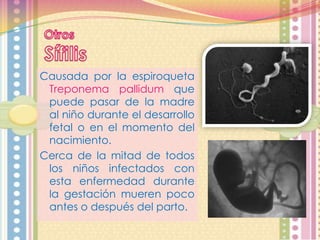 Causada por la espiroqueta
Treponema pallidum que
puede pasar de la madre
al niño durante el desarrollo
fetal o en el momento del
nacimiento.
Cerca de la mitad de todos
los niños infectados con
esta enfermedad durante
la gestación mueren poco
antes o después del parto.

 