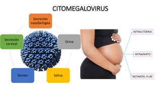 CITOMEGALOVIRUS
Secreción
nasofaríngea
Orina
SalivaSemen
Secreción
cervical
INTRAUTERINA
INTRAPARTO
NEONATAL X LM
 