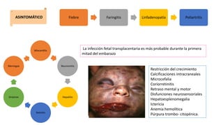 ASINTOMÁTICO Fiebre Faringitis Linfadenopatía Poliartritis
Miocarditis
Neumonitis
Hepatitis
Retinitis
Grastroe
Meningoe
La infección fetal transplacentaria es más probable durante la primera
mitad del embarazo
Restricción del crecimiento
Calcificaciones intracraneales
Microcefalia
Coriorretinitis
Retraso mental y motor
Disfunciones neurosensoriales
Hepatoesplenomegalia
Ictericia
Anemia hemolítica
Púrpura trombo- citopénica.
 