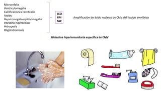 Microcefalia
Ventriculomegalia
Calcificaciones cerebrales
Ascitis
Hepatomegaliaesplenomegalia
Intestino hiperecoico
Hidropesía
Oligohidramnios
ECO
RM
TAC
Amplificación de ácido nucleico de CMV del líquido amniótico
Globulina hiperinmunitaria específica de CMV
 