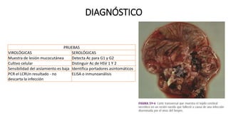 DIAGNÓSTICO
PRUEBAS
VIROLÓGICAS SEROLÓGICAS
Muestra de lesión mucocutánea Detecta Ac para G1 y G2
Cultivo celular Distinguir Ac de HSV 1 Y 2
Sensibilidad del aislamiento es baja Identifica portadores asintomáticos
PCR el LCRUn resultado - no
descarta la infección
ELISA o inmunoanálisis
 