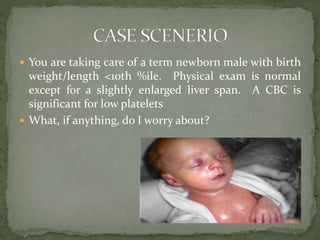  You are taking care of a term newborn male with birth
weight/length <10th %ile. Physical exam is normal
except for a slightly enlarged liver span. A CBC is
significant for low platelets
 What, if anything, do I worry about?
 