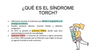 Torch (1) | PPTX