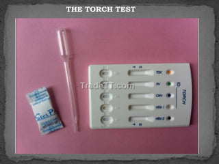 Torch Testing Labcorp Lab diagnosis of ToRCH complex | PPSX