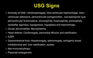  Anomaly of CNS –Ventriculomegaly, intra-ventricular haemorrhage, intra-
ventricular adhesions, periventricular echogenicities, sub-ependymal cyst,
periventricular leukomalacia, microcephaly, lissencephaly, porecephaly,
cerebellar agenesis, hypogenesis, hypoplasia and haemorrhage.
 Ocular abnormalities- Microphtalmia.
 Heart defects- Cardiomegaly, pericardial effusion and calcification.
 IUGR.
 Gastrointestinal tract -Hepatomegaly, splenomegaly, echogenic bowel,
intrabdominal and liver calcification, ascites.
 Non-immunehydrops.
 Placental enlargement.
 