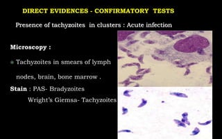 Microscopy :
 Tachyzoites in smears of lymph
nodes, brain, bone marrow .
Stain : PAS- Bradyzoites
Wright’s Giemsa- Tachyzoites
Presence of tachyzoites in clusters : Acute infection
DIRECT EVIDENCES - CONFIRMATORY TESTS
 