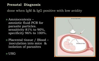  Amniocentesis –
amniotic fluid PCR for
parasite particles.
sensitivity 81% to 90%,
specificity 96% to 100%.
 Placental tissue / Blood –
inoculation into mice &
isolation of parasites
 USG
 