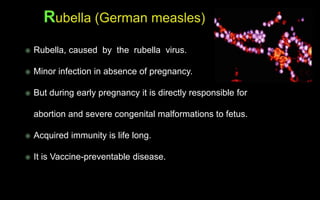  Rubella, caused by the rubella virus.
 Minor infection in absence of pregnancy.
 But during early pregnancy it is directly responsible for
abortion and severe congenital malformations to fetus.
 Acquired immunity is life long.
 It is Vaccine-preventable disease.
 