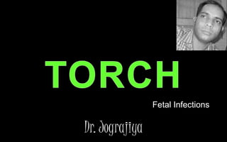 Fetal Infections
Dr. Jograjiya
 