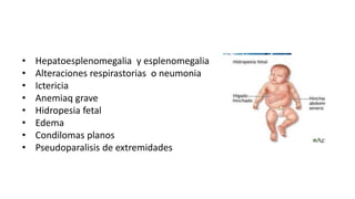 • Hepatoesplenomegalia y esplenomegalia
• Alteraciones respirastorias o neumonia
• Ictericia
• Anemiaq grave
• Hidropesia fetal
• Edema
• Condilomas planos
• Pseudoparalisis de extremidades
 