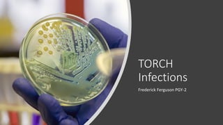 TORCH
Infections
Frederick Ferguson PGY-2
 