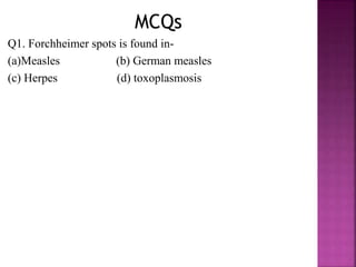  Virus causing varicella (chicken pox) is also responsible for
herpes zoster (shingles).
 Chicken pox results from primary infection of V-ZV infection,
following which virus may remain latent in sensory ganglia
(dorsal root ganglia).
 Zoster results from reactivation of latent virus later in life or if
the host become immunosuppressed.
 Primary mode of transmission- respiratory droplets, can spread
through contact with vesicular lesion.
 Contagious period 2 days before and 5 days after the onset of
rashes.
 Incubation period- 10-21 days
 