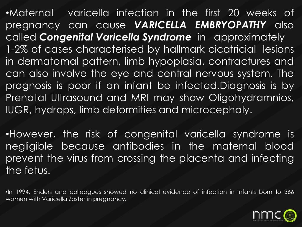 Torch infections in pregnancy presentation
