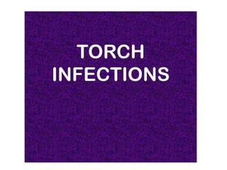 TORCH INFECTIONS
   TORCH BY
INFECTIONS
  NKIRU VICTORIA
  CHUKWUKAEME
       GROUP 42
    6TH COURSE
 
