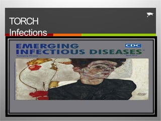 TORCH IN INFECTION ppt for the Nursing Students | PPTX