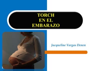 TORCH
      EN EL
    EMBARAZO



         Jacqueline Vargas Denen




1
 