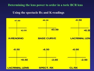 Toric Rgp Fit Toric rgp fit | PPT