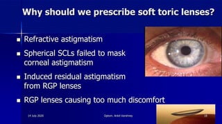 Why should we prescribe soft toric lenses?
 Refractive astigmatism
 Spherical SCLs failed to mask
corneal astigmatism
 Induced residual astigmatism
from RGP lenses
 RGP lenses causing too much discomfort
14 July 2020 Optom. Ankit Varshney 18
 