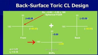 Back-Surface Toric CL Design
Rx: –2.00 / –3.00 x 180
Spherical FOZR90
Front
180
(+48.00)
(+48.00)
90
Back
180
(–50.00)
(–53.00)
90
BVPs
180
–2.00
–5.00
n = 1.43
tc = 0.15

+
14 July 2020 Optom. Ankit Varshney 25
 