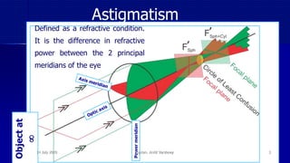 Astigmatism
Defined as a refractive condition.
It is the difference in refractive
power between the 2 principal
meridians of the eye
Powermeridian
Objectat

14 July 2020 Optom. Ankit Varshney 3
 