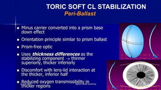  Minus carrier converted into a prism base
down effect
 Orientation principle similar to prism ballast
 Prism-free optic
 Uses thickness differences as the
stabilizing component  thinner
superiorly, thicker inferiorly
 Discomfort with lens-lid interaction at
the thicker, inferior half
 Reduced oxygen transmissibility in
thicker regions
Peri-Ballast
TORIC SOFT CL STABILIZATION
14 July 2020 Optom. Ankit Varshney 31
 