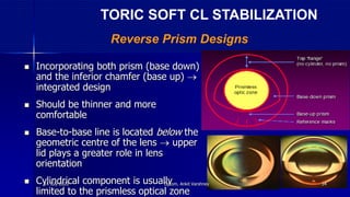  Incorporating both prism (base down)
and the inferior chamfer (base up) 
integrated design
 Should be thinner and more
comfortable
 Base-to-base line is located below the
geometric centre of the lens  upper
lid plays a greater role in lens
orientation
 Cylindrical component is usually
limited to the prismless optical zone
Reverse Prism Designs
TORIC SOFT CL STABILIZATION
14 July 2020 Optom. Ankit Varshney 34
 