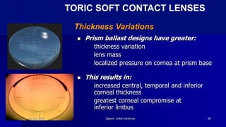  Prism ballast designs have greater:
- thickness variation
- lens mass
- localized pressure on cornea at prism base
 This results in:
- increased central, temporal and inferior
corneal thickness
- greatest corneal compromise at
inferior limbus
TORIC SOFT CONTACT LENSES
Thickness Variations
14 July 2020 Optom. Ankit Varshney 36
 