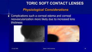 Physiological Considerations
 Complications such a corneal edema and corneal
neovascularization more likely due to increased lens
thickness
TORIC SOFT CONTACT LENSES
14 July 2020 Optom. Ankit Varshney 38
 