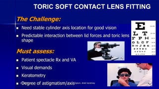The Challenge:
 Need stable cylinder axis location for good vision
 Predictable interaction between lid forces and toric lens
shape
Must assess:
 Patient spectacle Rx and VA
 Visual demands
 Keratometry
 Degree of astigmatism/axis
TORIC SOFT CONTACT LENS FITTING
14 July 2020 Optom. Ankit Varshney 39
 