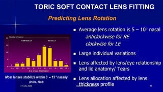  Average lens rotation is 5 – 10 nasal
- anticlockwise for RE
- clockwise for LE
 Large individual variations
 Lens affected by lens/eye relationship
and lid anatomy/ Tears
 Lens allocation affected by lens
thickness profile
Most lenses stabilize within 0 – 15 nasally
(Irvins, 1984)
Predicting Lens Rotation
TORIC SOFT CONTACT LENS FITTING
14 July 2020 Optom. Ankit Varshney 46
 