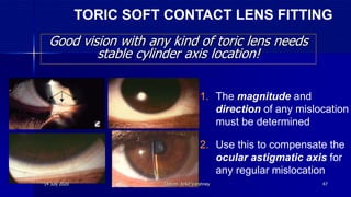 Good vision with any kind of toric lens needs
stable cylinder axis location!
1. The magnitude and
direction of any mislocation
must be determined
2. Use this to compensate the
ocular astigmatic axis for
any regular mislocation
TORIC SOFT CONTACT LENS FITTING
14 July 2020 Optom. Ankit Varshney 47
 