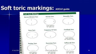 Soft toric markings: AOCLE guide
14 July 2020 Optom. Ankit Varshney 49
 