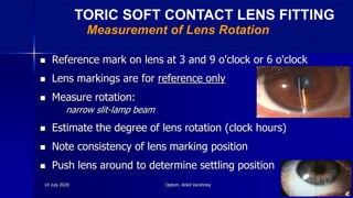  Reference mark on lens at 3 and 9 o'clock or 6 o'clock
 Lens markings are for reference only
 Measure rotation:
- narrow slit-lamp beam
 Estimate the degree of lens rotation (clock hours)
 Note consistency of lens marking position
 Push lens around to determine settling position
Measurement of Lens Rotation
TORIC SOFT CONTACT LENS FITTING
14 July 2020 Optom. Ankit Varshney 51
 