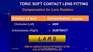 Rotation of lens: Compensation: (degrees)
Clockwise (Left)  ADD
Anticlockwise (Right)  SUBTRACT
Compensation for Lens Rotation
L A R S
Add or subtract amount of rotation to the
axis of the contact lens Rx
TORIC SOFT CONTACT LENS FITTING
14 July 2020 Optom. Ankit Varshney 53
 