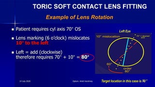  Patient requires cyl axis 70° OS
 Lens marking (6 o’clock) mislocates
10° to the left
 Left = add (clockwise)
therefore requires 70° + 10° = 80°
Target location in this case is 70°
Left Eye
order
80°
60°
10° mislocation 70° = desired
axis
Example of Lens Rotation
TORIC SOFT CONTACT LENS FITTING
14 July 2020 Optom. Ankit Varshney 56
 