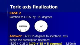 Toric axis finalization
CASE 2
Rotation to L.H.S by 15 degrees
Answer - ADD 15 degrees to spectacle axis
hence the prescription becomes:-
-3.00 / -2.25 X (170 + 15 = 5 degrees) 8.50mm
150
7214 July 2020 Optom. Ankit Varshney
 