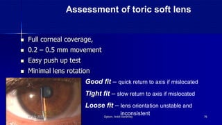  Full corneal coverage,
 0.2 – 0.5 mm movement
 Easy push up test
 Minimal lens rotation
Good fit – quick return to axis if mislocated
Tight fit – slow return to axis if mislocated
Loose fit – lens orientation unstable and
inconsistent
Assessment of toric soft lens
14 July 2020 Optom. Ankit Varshney 76
 